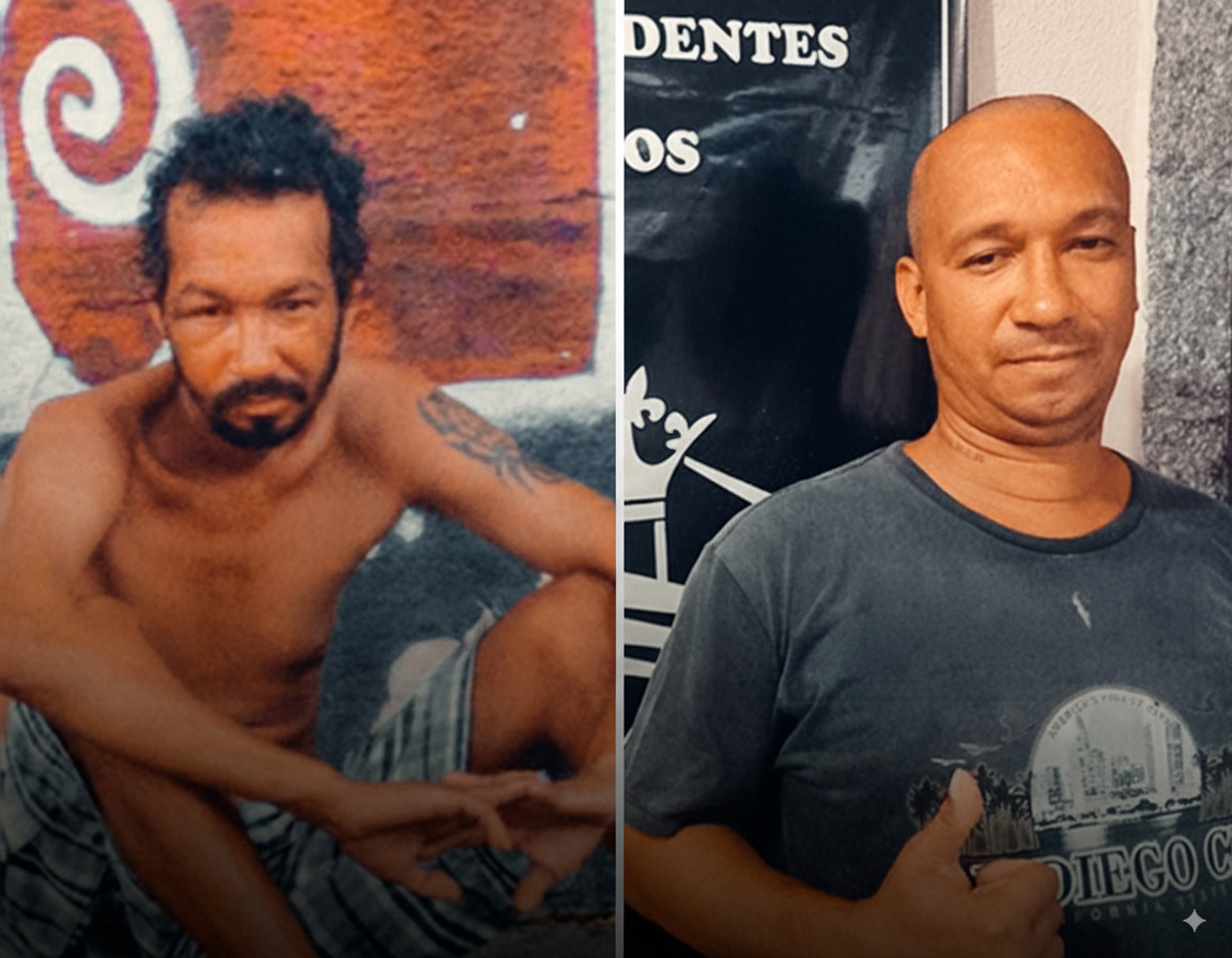 Antes e Depois